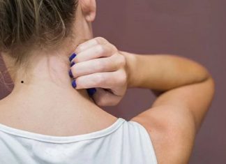 Nốt ruồi sau gáy